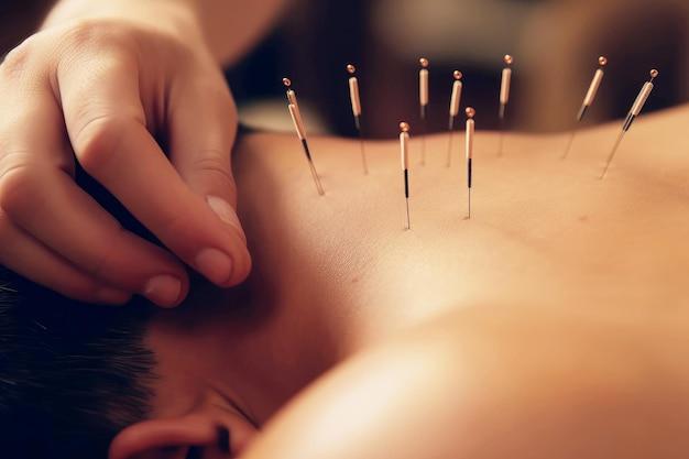 Are veterinarians practice holistic treatments like acupuncture? 