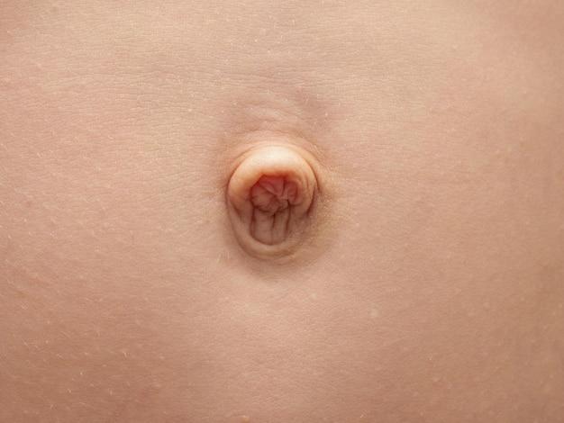 Can a 15 year old get a belly button piercing? 