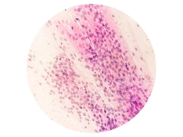 Can a man test negative for trichomoniasis and still have it? 