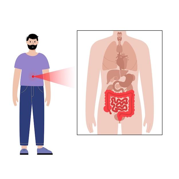 Can caffeine cause rectal bleeding? 