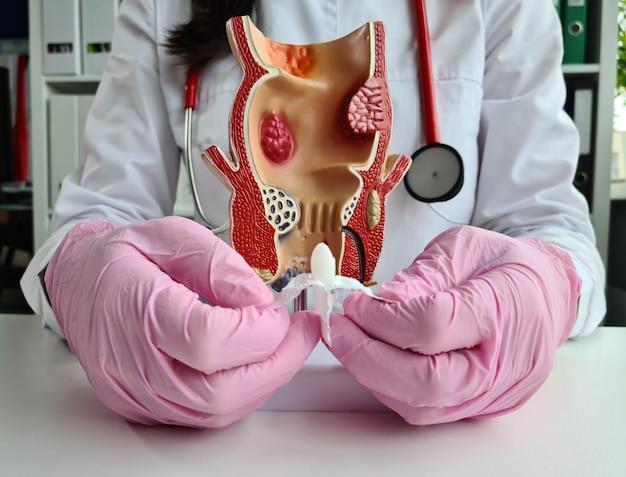 Can caffeine cause rectal bleeding? 