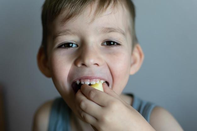 Can I eat chips 3 weeks after wisdom teeth extraction? 