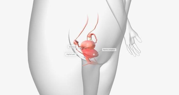 Can ovarian cyst be sexually transmitted? 