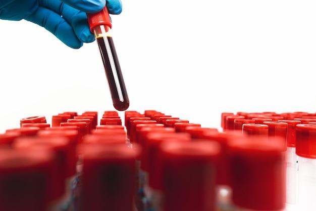 How much does a Honda diagnostic cost? 