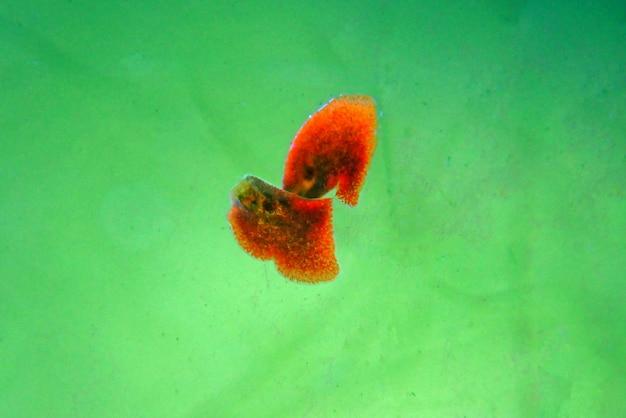 How do flatworms remove waste? 