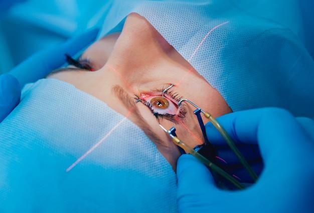 How long after cataract surgery can you bend and lift? 