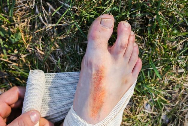 How long should you be out of work for a sprained ankle? 