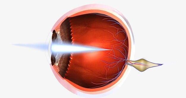 How much does laser photocoagulation cost? 