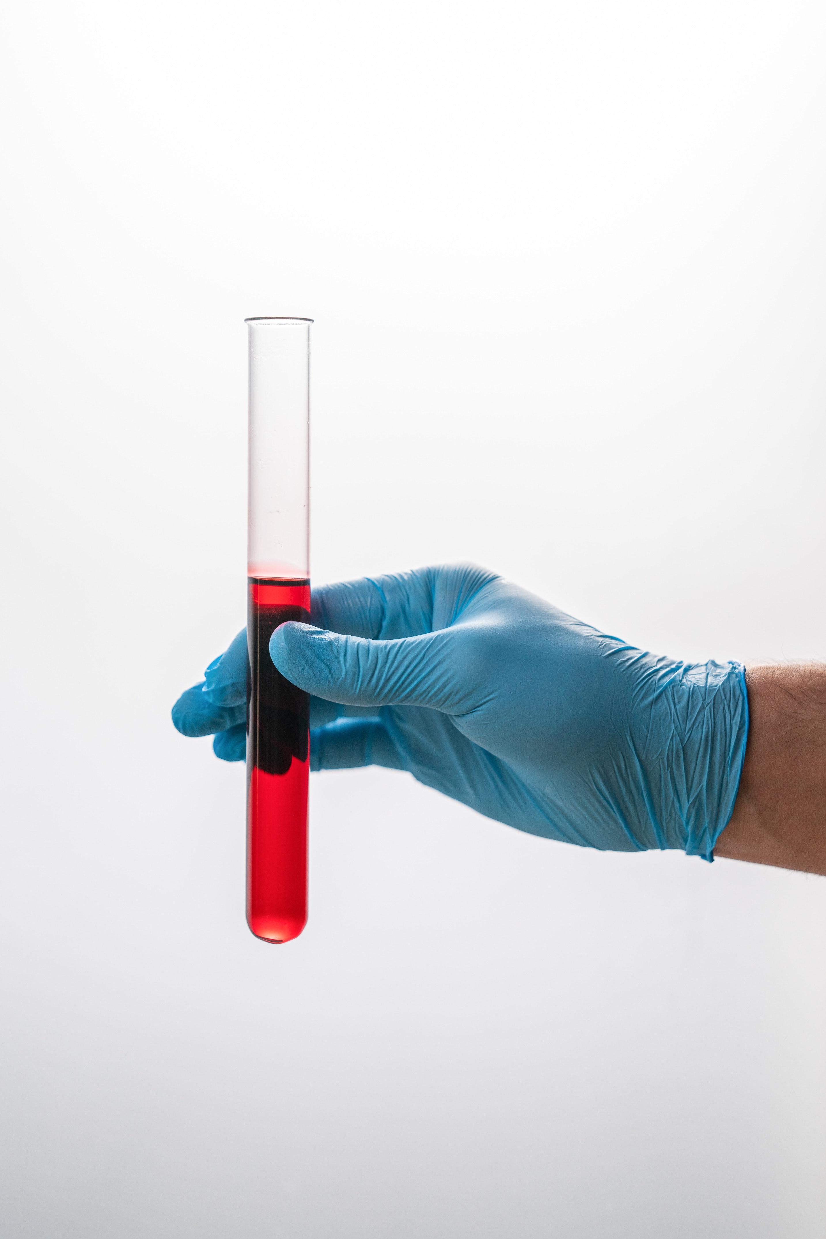 How often should you change a NG tube? 