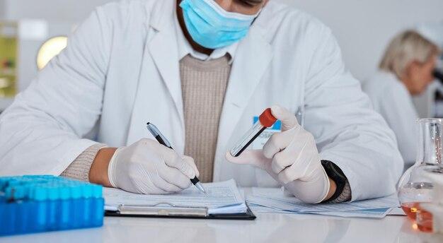 How do you write the significance of the study sample? 