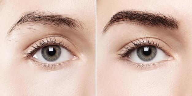 How can I clean my eyelashes after Lasik? 