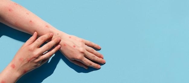 Is death by electric shock painful? 