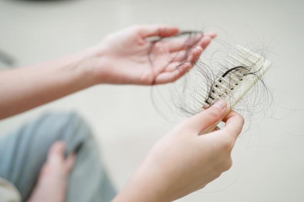 Is hair loss from Mirena permanent? 