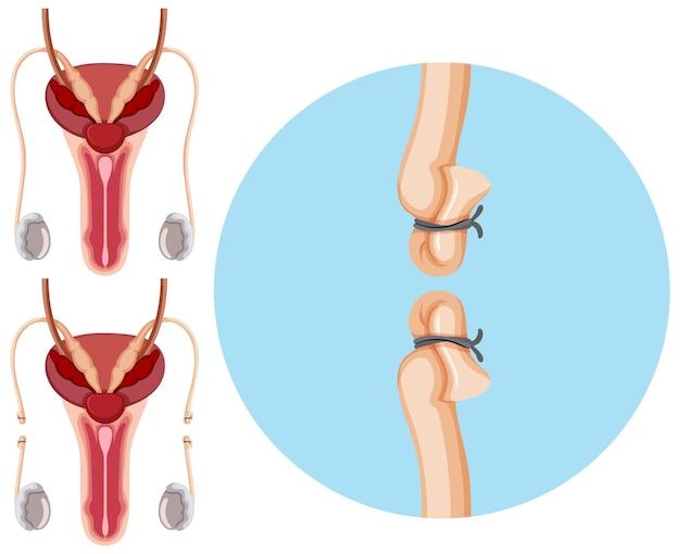 Is there a difference between male and female blood? 