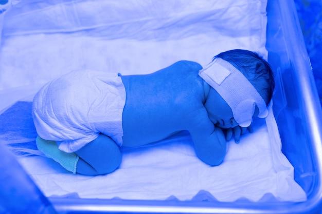 Is jaundice caused by water pollution? 