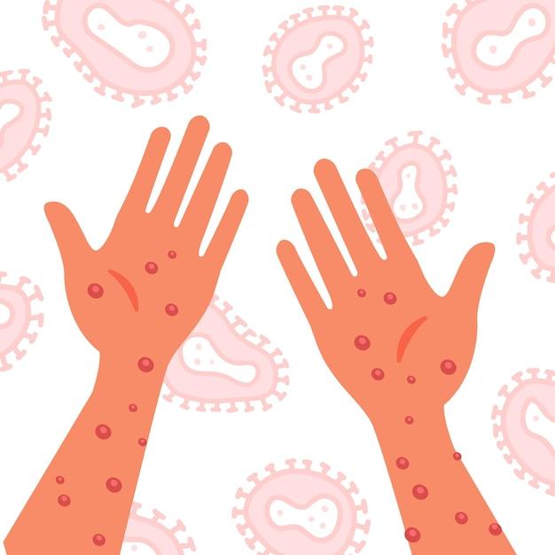 Where does the mono virus come from? 