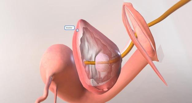 Should I take calcium after hysterectomy? 