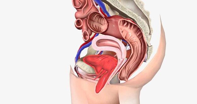 Which body cavity would have to be opened for the removal of the uterus or womb? 