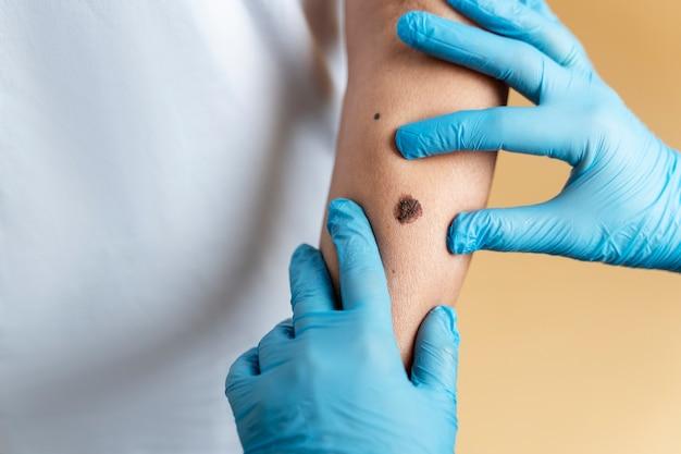 How much does an arm transplant cost? 