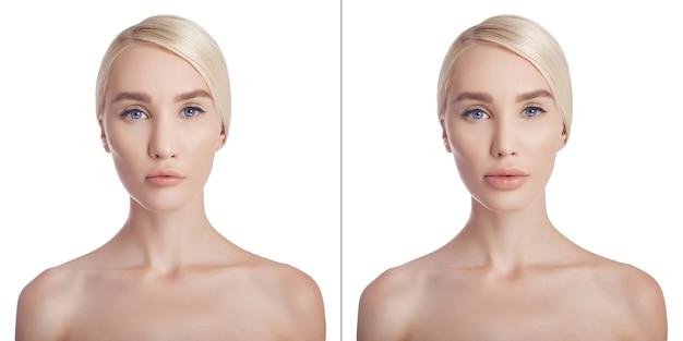 What is the medical term for pertaining to the nose and lip? 