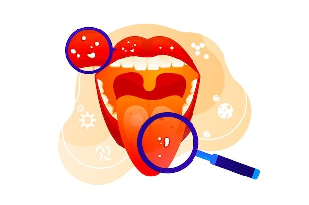 What is the process of Gustation? 