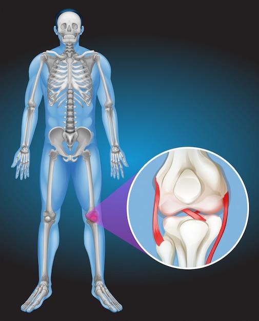 What is the strongest joint in the body? 