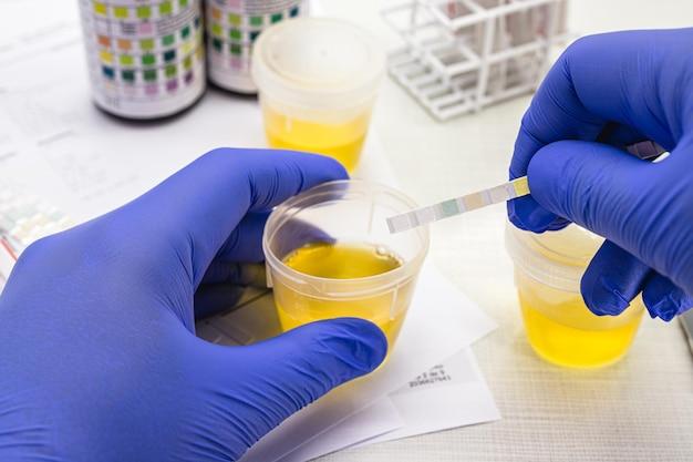 Why would a urine test come back inconclusive? 