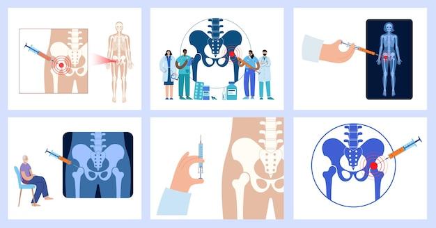 What can go wrong with a cortisone injection? 