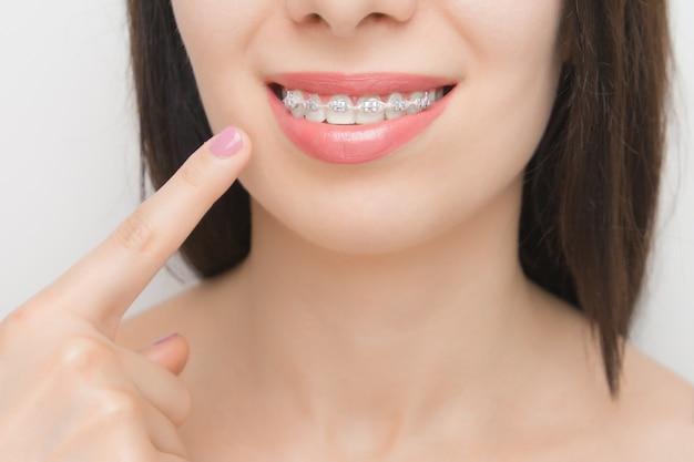 What do you call a friend with braces? 