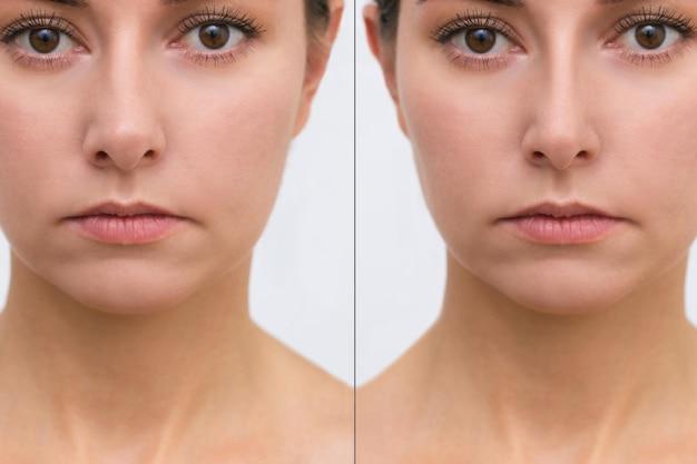 What does having a big nose mean? 