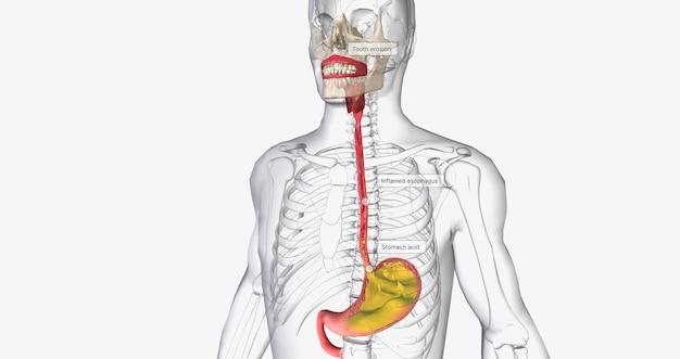 What happens if you touch stomach acid? 