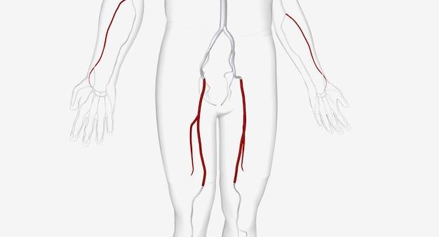 What side is your femoral artery on? 