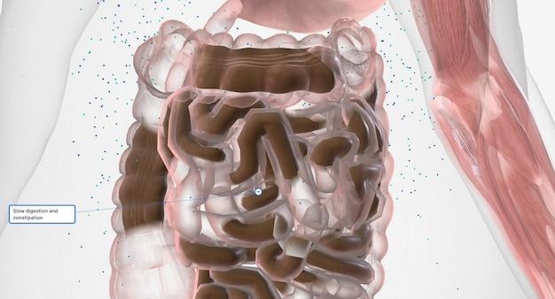 Which pain reliever does not cause constipation? 