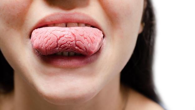 Why does my tongue burn when I eat garlic? 