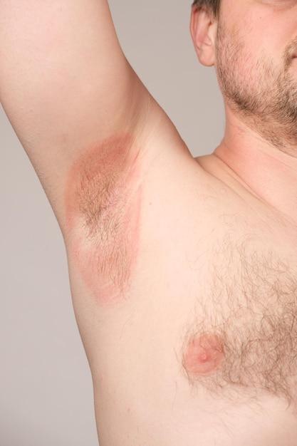 Why does the muscle under my armpit hurt? 