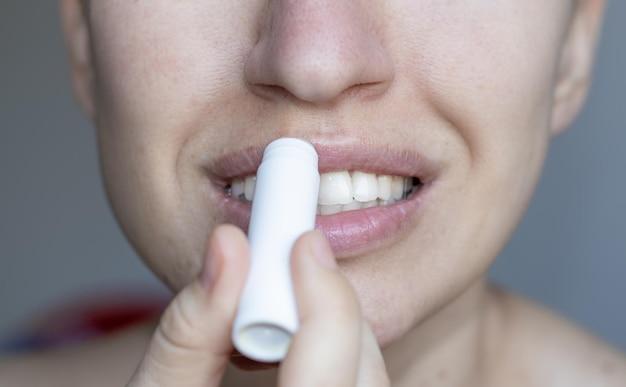 Why is Carmex bad? 