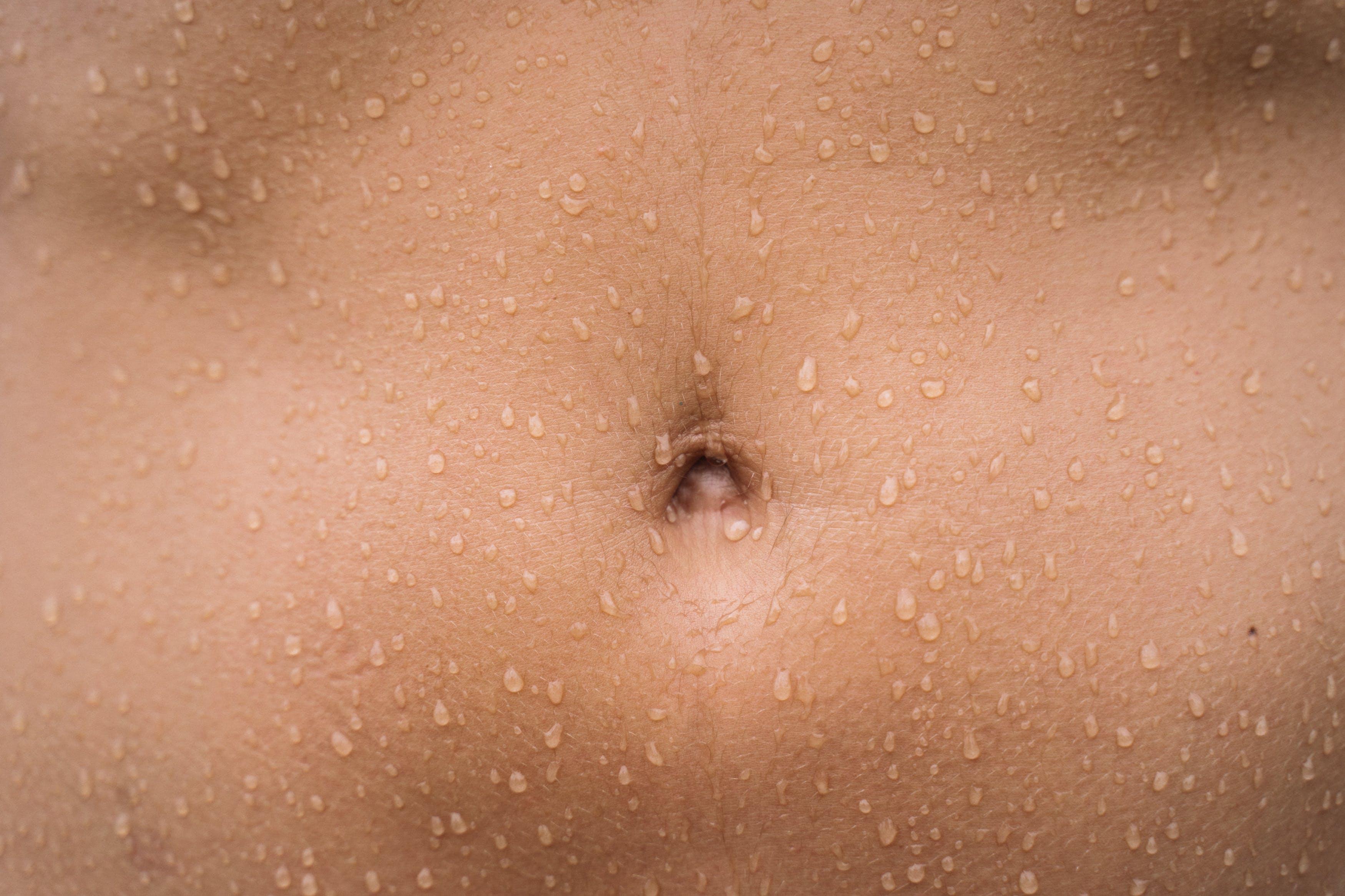 Why is my belly button bleeding male? 