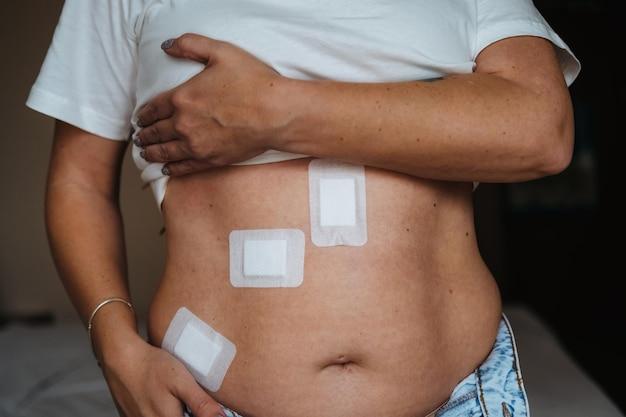 Why is my stomach bigger after inguinal hernia surgery? 