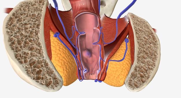 Will they remove hemorrhoids during colonoscopy? 